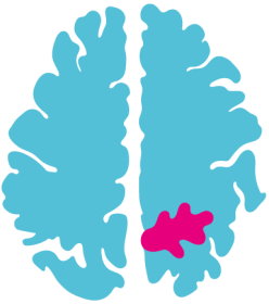 Centrum pro nádory mozku a&nbsp;míchy